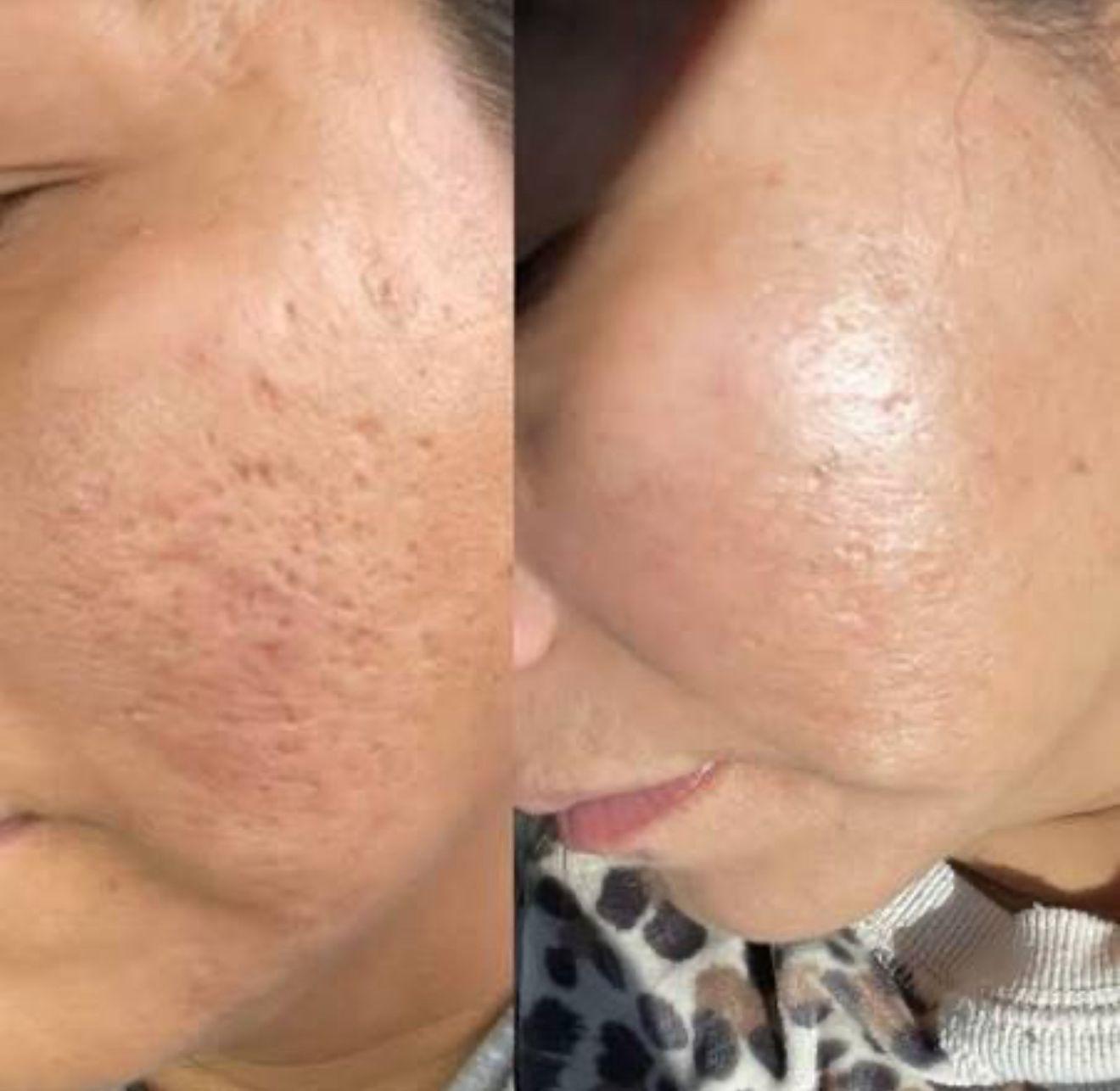 Professional skincare product — serum bottle