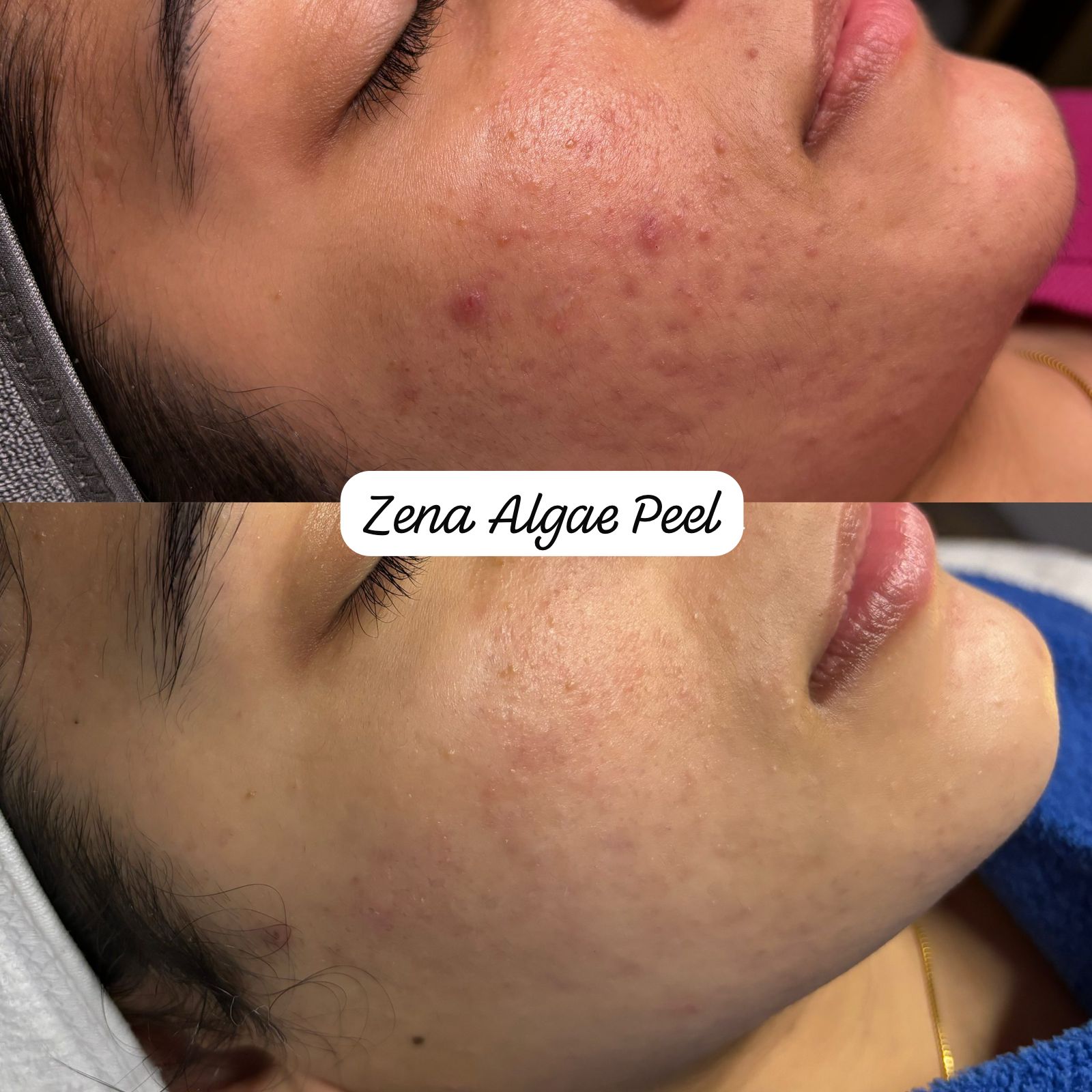 Professional skincare product — serum bottle